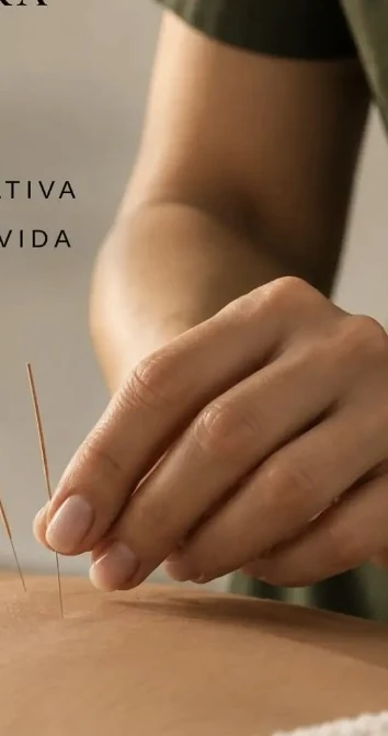 Aplicação de agulhas em sessão de acupuntura